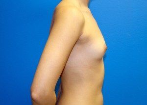 RGV Cosmetic Surgery Vein Care 