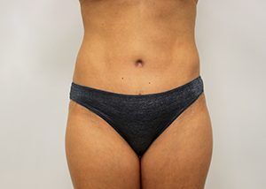 RGV Cosmetic Surgery Vein Care 