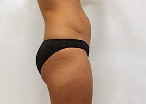 RGV Cosmetic Surgery Vein Care 