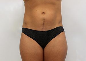 RGV Cosmetic Surgery Vein Care 
