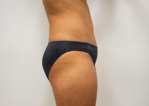 RGV Cosmetic Surgery Vein Care 