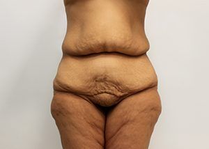 RGV Cosmetic Surgery Vein Care 