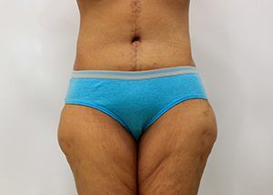 RGV Cosmetic Surgery Vein Care 