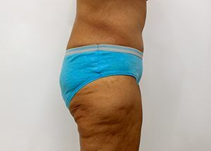 RGV Cosmetic Surgery Vein Care 