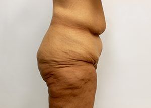 RGV Cosmetic Surgery Vein Care 