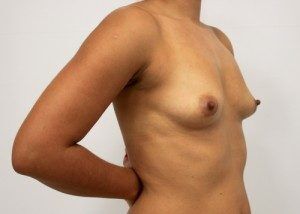 RGV Cosmetic Surgery Vein Care 