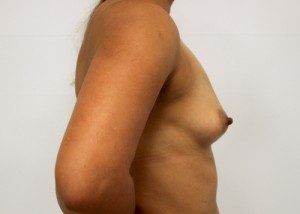 RGV Cosmetic Surgery Vein Care 