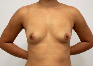 RGV Cosmetic Surgery Vein Care 