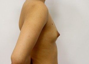 RGV Cosmetic Surgery Vein Care 