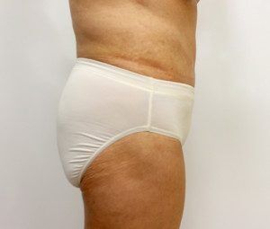 RGV Cosmetic Surgery Vein Care 
