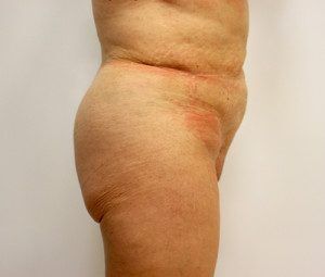 RGV Cosmetic Surgery Vein Care 