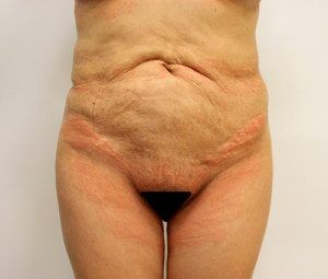 RGV Cosmetic Surgery Vein Care 