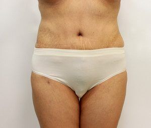 RGV Cosmetic Surgery Vein Care 