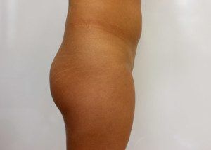 RGV Cosmetic Surgery Vein Care 
