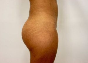 RGV Cosmetic Surgery Vein Care 