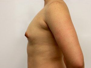 RGV Cosmetic Surgery Vein Care 