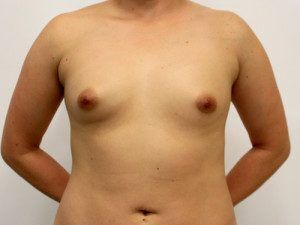 RGV Cosmetic Surgery Vein Care 