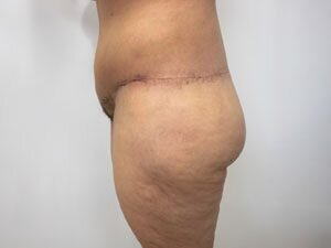 RGV Cosmetic Surgery Vein Care 