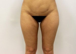RGV Cosmetic Surgery Vein Care 