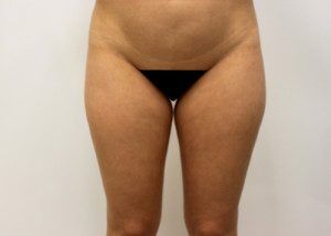 RGV Cosmetic Surgery Vein Care 