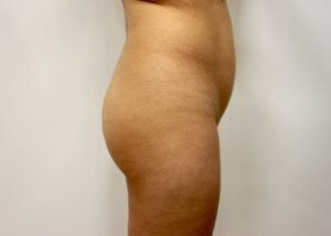 RGV Cosmetic Surgery Vein Care 