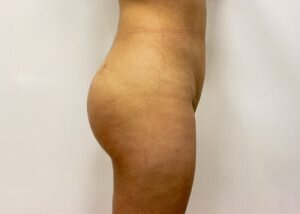 RGV Cosmetic Surgery Vein Care 