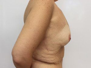 RGV Cosmetic Surgery Vein Care 