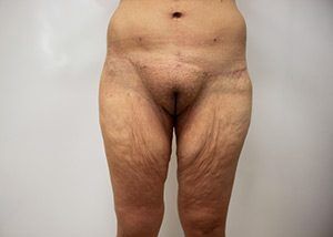 RGV Cosmetic Surgery Vein Care 