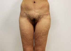 RGV Cosmetic Surgery Vein Care 
