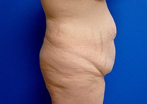 RGV Cosmetic Surgery Vein Care 