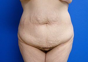 RGV Cosmetic Surgery Vein Care 