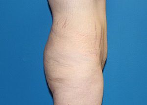RGV Cosmetic Surgery Vein Care 