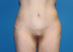 RGV Cosmetic Surgery Vein Care 