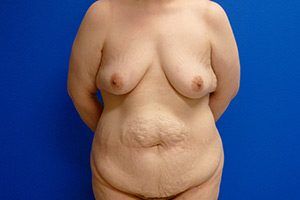RGV Cosmetic Surgery Vein Care 