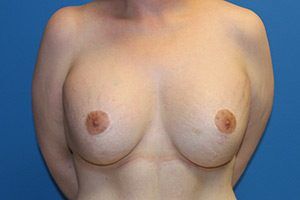 RGV Cosmetic Surgery Vein Care 