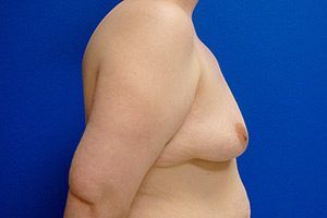 RGV Cosmetic Surgery Vein Care 