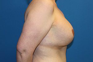 RGV Cosmetic Surgery Vein Care 