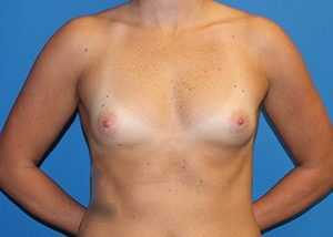 RGV Cosmetic Surgery Vein Care 