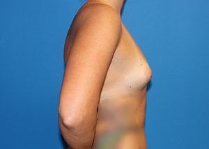 RGV Cosmetic Surgery Vein Care 