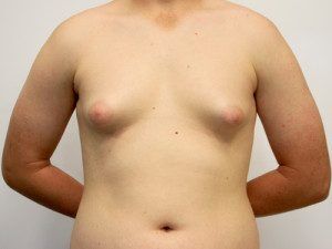 RGV Cosmetic Surgery Vein Care 