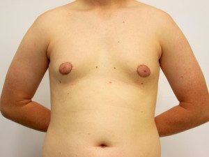 RGV Cosmetic Surgery Vein Care 