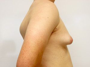 RGV Cosmetic Surgery Vein Care 