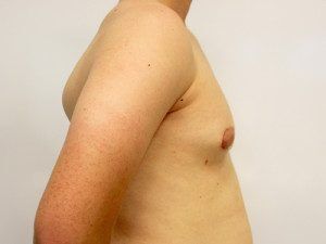 RGV Cosmetic Surgery Vein Care 