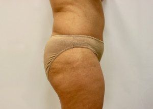 RGV Cosmetic Surgery Vein Care 