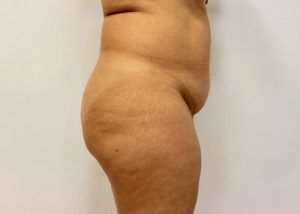 RGV Cosmetic Surgery Vein Care 