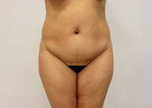 RGV Cosmetic Surgery Vein Care 