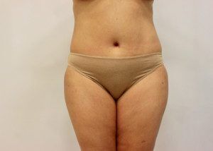 RGV Cosmetic Surgery Vein Care 