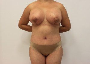 RGV Cosmetic Surgery Vein Care 