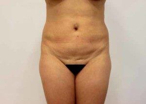 RGV Cosmetic Surgery Vein Care 