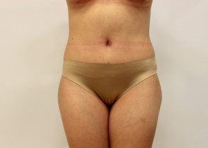 RGV Cosmetic Surgery Vein Care 